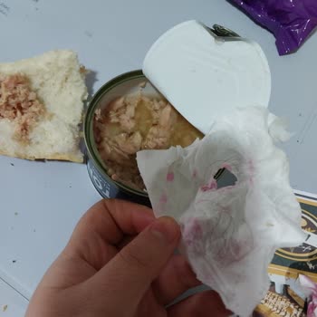 Konserve Ton Balığında Kıl Bulunması Ve Hijyen Şikayeti