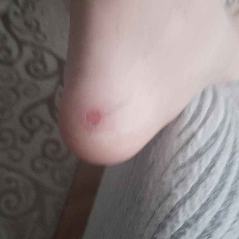 Ayakkabının Deri Parçalanması Nedeniyle İade Talebi