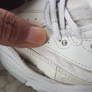 Skechers Ayakkabısında Ayıplı Yırtılma Ve İade Talebimin Reddedilmesi