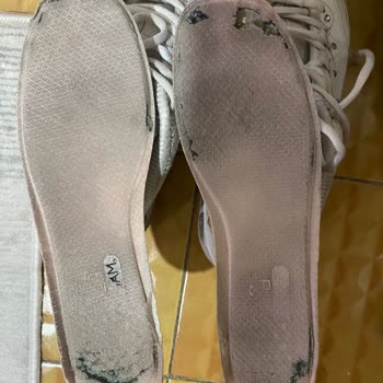 Skechers Ayakkabısında Ayıplı Yırtılma Ve İade Talebimin Reddedilmesi