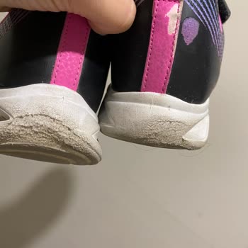 Skechers Çocuk Ayakkabısında Topuk Erimesi Ve Değişim Talebi