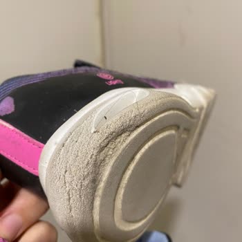 Skechers Çocuk Ayakkabısında Topuk Erimesi Ve Değişim Talebi