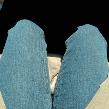 Mavi Sky Ve Victoria Modellerinde Renk Solması Ve Dikiş Hatası İade Talebi