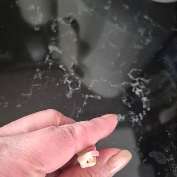 Özel Estet Ağız ve Diş Sağlığı Polikliniği İmplant ve Protez Tedavim Tam Bir Hüsrana Dönüştü