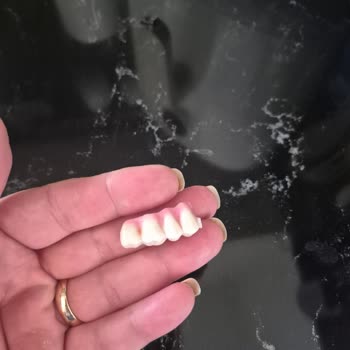 Özel Estet Ağız ve Diş Sağlığı Polikliniği İmplant ve Protez Tedavim Tam Bir Hüsrana Dönüştü