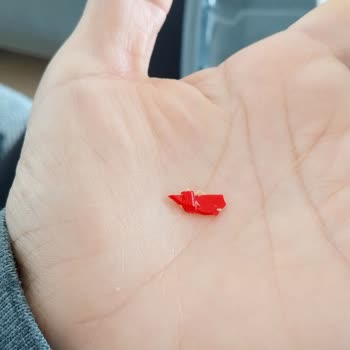 Tatbak Kurabiyesinde Sert Plastik Parça Bulunması Diş Etime Çarptı