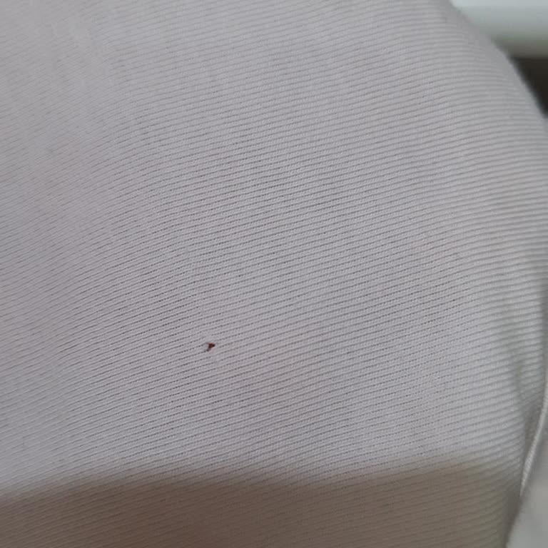 Hasarlı Atlet Değişim Talebi