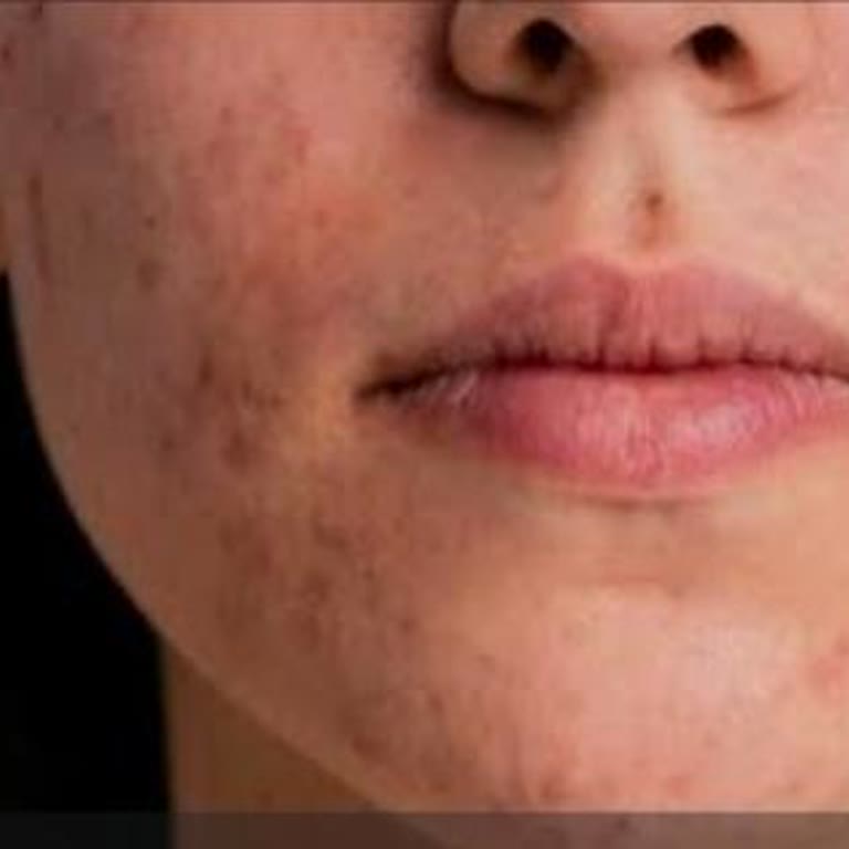 Tüketici Hakem Heyeti Kararına Rağmen Haksız Borç Tahsilatı Ve Hakaretli İcra Takibi