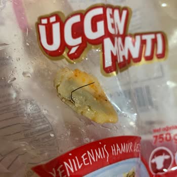 Kemal Usta Mantısında Tel Çıktı: Ağızda Yaran Güvenlik Sorunu