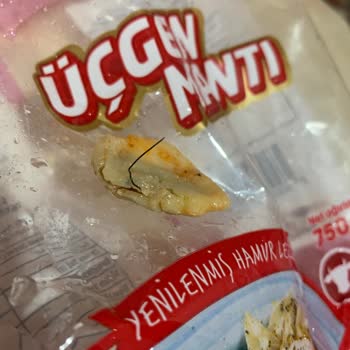 Kemal Usta Mantısında Tel Çıktı: Ağızda Yaran Güvenlik Sorunu