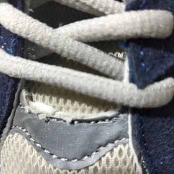 Defolu Ayakkabılar İçin Tam İade Talebi