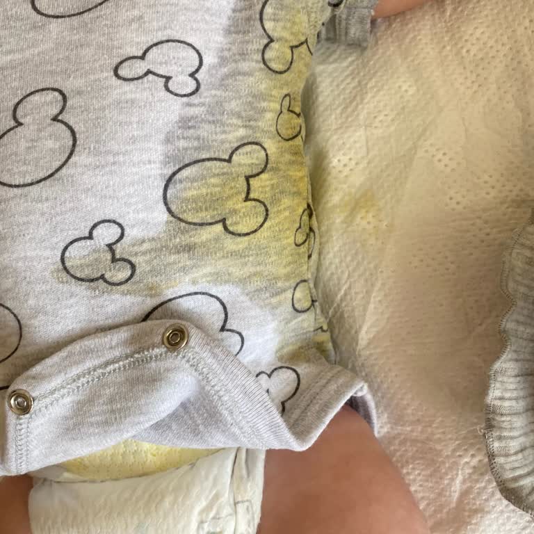 Prima Premium Care Bebek Bezinde Sürekli Sızma Ve Kaçak Problemi