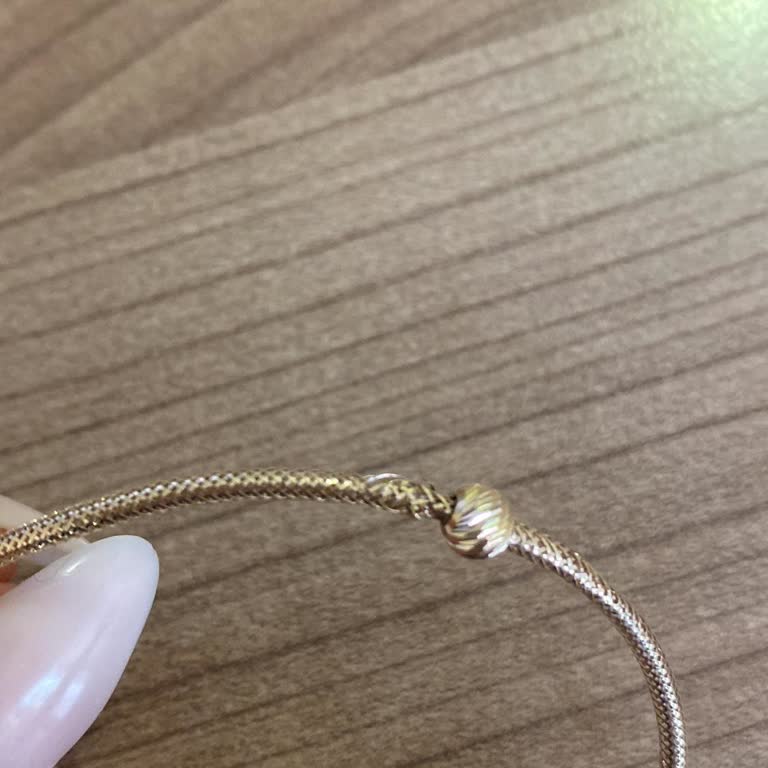 İtalyan Bileklik Deforme Oldu, Şirket Kullanıcıyı Suçlayıp Çözüm Sunmadı