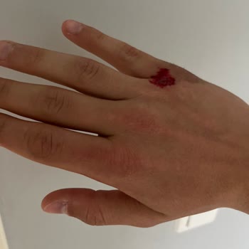 Yunuseli TOKİ Yürüyüş Parkurundaki Kırık Parkeler Düşme Tehlikesi Yaratıyor