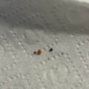 Hero Baby Pekmezli Bebek Mamasında Sert Yabancı Parçalar Bulundu, İnceleme Ve Açıklama Talebi