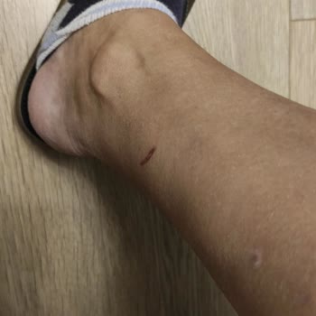 Ayakkabının Kısa Sürede Yara Açması Ve Mağazanın Kullanıcı Hatası İddiası