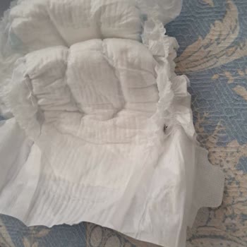 Molfix Bebek Bezinde İç Astar Eksikliği Ve Kötü Emicilik