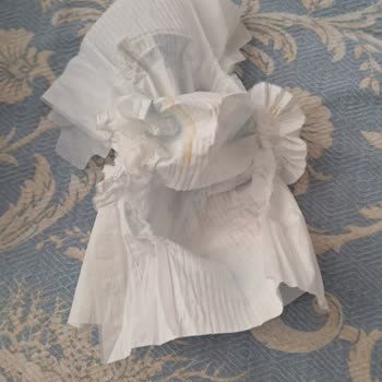 Molfix Bebek Bezinde İç Astar Eksikliği Ve Kötü Emicilik