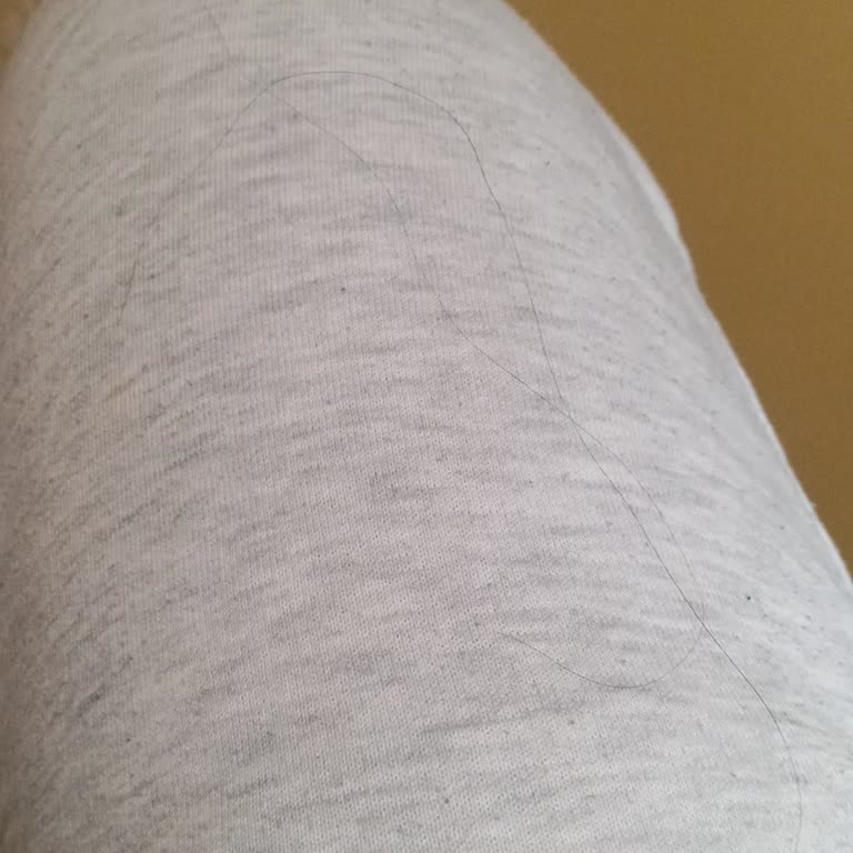 Samba Cipsinde Saç Teli Bulundu, Hijyen Ve Kalite Denetimi Talebi