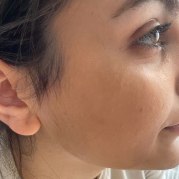 Alix Avien Ürünlerinde Renk Uyumsuzluğu Ve Müşteri Hizmetlerinden Destek Eksikliği