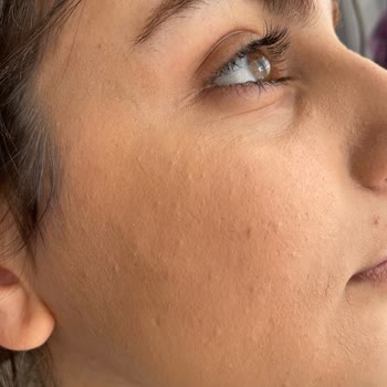 Alix Avien Ürünlerinde Renk Uyumsuzluğu Ve Müşteri Hizmetlerinden Destek Eksikliği