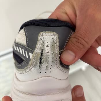 Nike Ayakkabımda Üretim Hatası Ve Yara Oluşması: Garanti Reddi