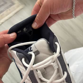 Nike Ayakkabımda Üretim Hatası Ve Yara Oluşması: Garanti Reddi