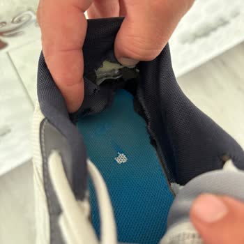 Nike Ayakkabımda Üretim Hatası Ve Yara Oluşması: Garanti Reddi