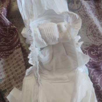 Molfix 4 Numaralı Bebek Bezlerinde Yan Sızdırma Sorunu