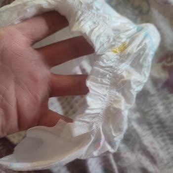 Molfix 4 Numaralı Bebek Bezlerinde Yan Sızdırma Sorunu