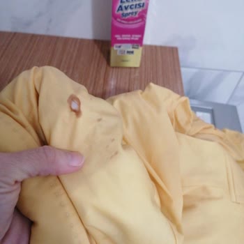 Dermojin Leke Çıkarıcı Ürünle Ceketim Yırtıldı, Ücret Ve Zararın Geri Ödenmesini İstiyorum