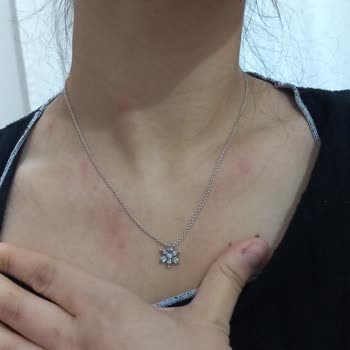 Baza Başlığındaki Tahta Kuruları: Sağlık Sorunu Ve Ücret İadesi Talebi
