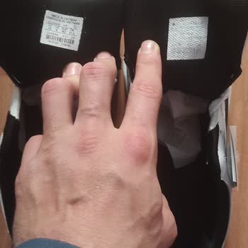 Yanıltıcı Görseller Ve Renk Hatalı Ayakkabılar Sonrası Satıcı İlgisizliği