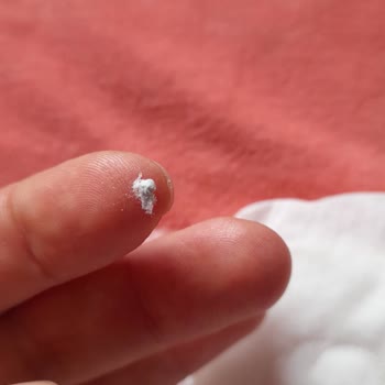 Molped Gece Pedi İçinde Yabancı Madde Çıkması Nedeniyle Hijyen Şikayeti