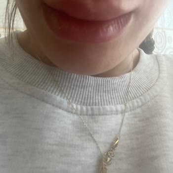 Yetersiz Eğitimli Uzman Nedeniyle Botoks Ve Dolgu İşlemlerinde Asimetri Ve İade Talebi