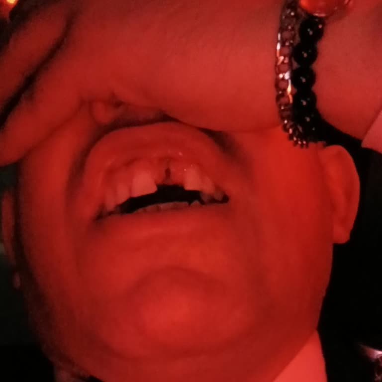 İmplant Hatası Ve 12 Aylık Bekleme Süreci Mağduriyetim