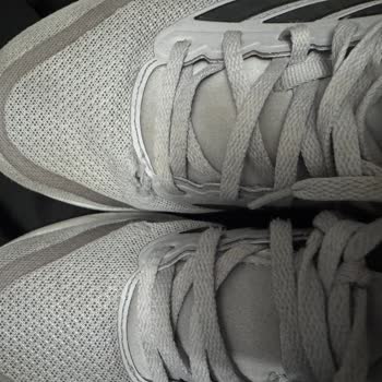 Adidas Ayakkabısında Erken Yıpranma, Mağaza Kullanıcı Hatası İddiası