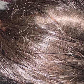 Markanın Bebek Şampuanı Saçta Jöle Kalıntısı Ve Kepek Sorunu