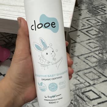 Markanın Bebek Şampuanı Saçta Jöle Kalıntısı Ve Kepek Sorunu