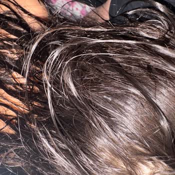 Markanın Bebek Şampuanı Saçta Jöle Kalıntısı Ve Kepek Sorunu