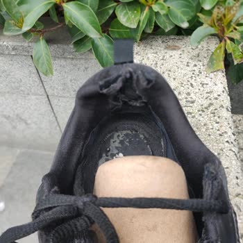 Skechers Ayakkabısında 3 Ayda Deformasyon Ve Garanti İhlali