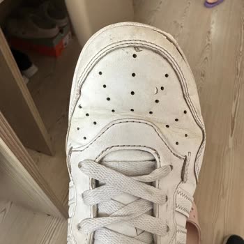 Adidas Hoops 4.0 Sneaker’da Ön Kısım Açılması Ve Kullanıcı Hatası İddiası