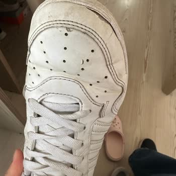 Adidas Hoops 4.0 Sneaker’da Ön Kısım Açılması Ve Kullanıcı Hatası İddiası