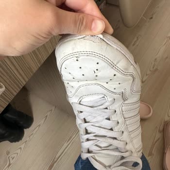 Adidas Hoops 4.0 Sneaker’da Ön Kısım Açılması Ve Kullanıcı Hatası İddiası