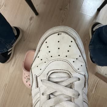 Adidas Hoops 4.0 Sneaker’da Ön Kısım Açılması Ve Kullanıcı Hatası İddiası