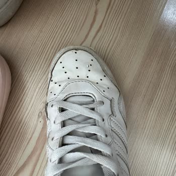 Adidas Hoops 4.0 Sneaker’da Ön Kısım Açılması Ve Kullanıcı Hatası İddiası