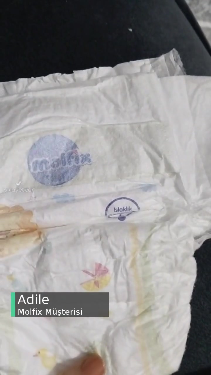 Molfix Bebek Bezinde Böcek Çıktı videonun kapak resmi