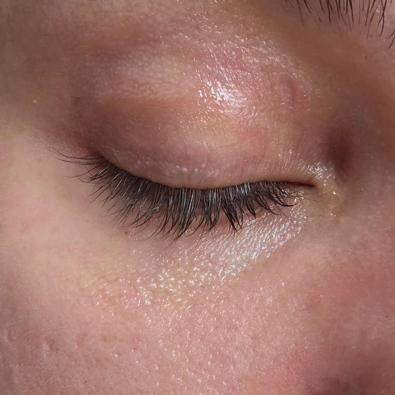 Pure Algue 3’ü 1 Arada Yüz Yıkama Jelinde Şiddetli Alerjik Reaksiyon Ve Ürün İadesi Talebi