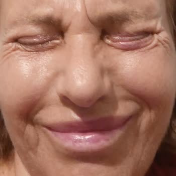 estetik ameliyat sonrası mağduriyet Tam Paket Sözleşmesi İhlali, Alın Germe İadesiz Ve Göz Kapağı Kalıcı Sorunları