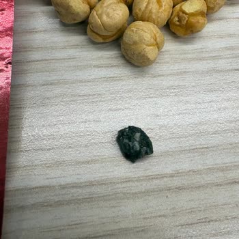 İçinde Taş Çıkan Kuruyemişte Diş Kırılması Ve Sağlık Tehlikesi